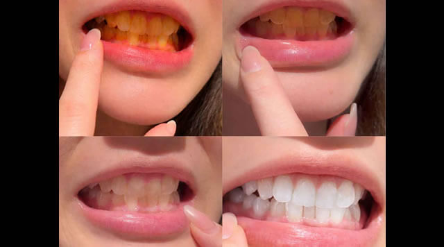 キラトスの効果を実際に検証